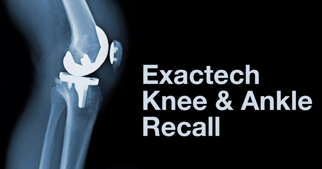 Exactech knee  Removal: The Risks and Complications You Need to Know